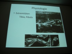 Imagen ecográfica de extremidad fetal